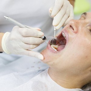 Woman receiving a dental cleaning